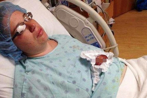 生命的奇迹，5岁抗癌男孩告别肝母细胞瘤的旅程
